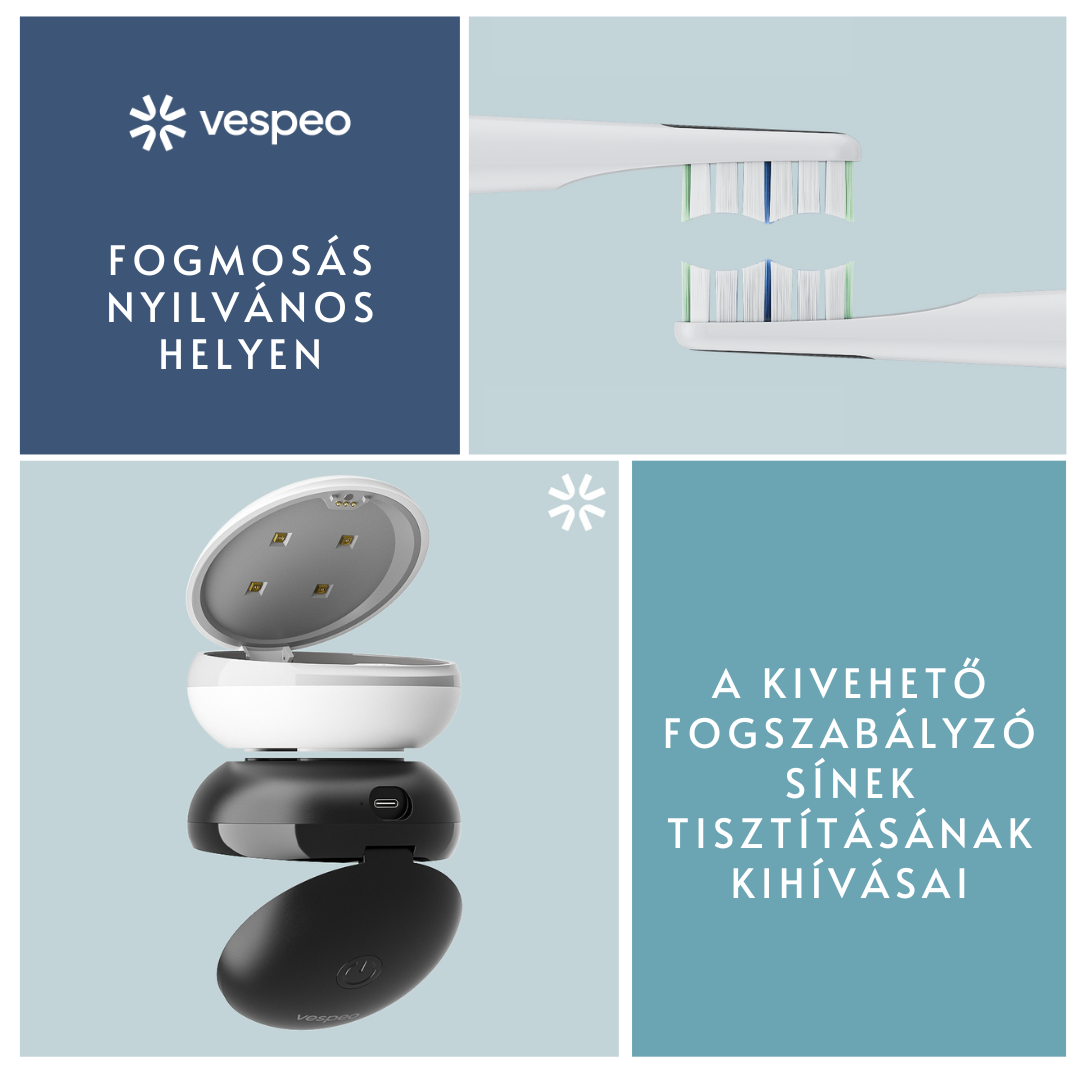 FOGMOSÁS NYILVÁNOS HELYEN? – A KIVEHETŐ FOGSZABÁLYZÓ SÍNEK TISZTÍTÁSÁNAK KIHÍVÁSAI