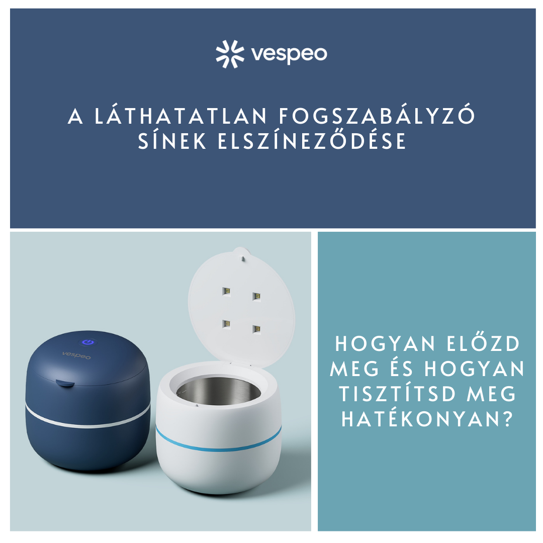 LÁTHATATLAN FOGSZABÁLYZÓ SÍNEK ELSZÍNEZŐDÉSE - Hogyan előzd meg és hogyan tisztítsd meg hatékonyan?