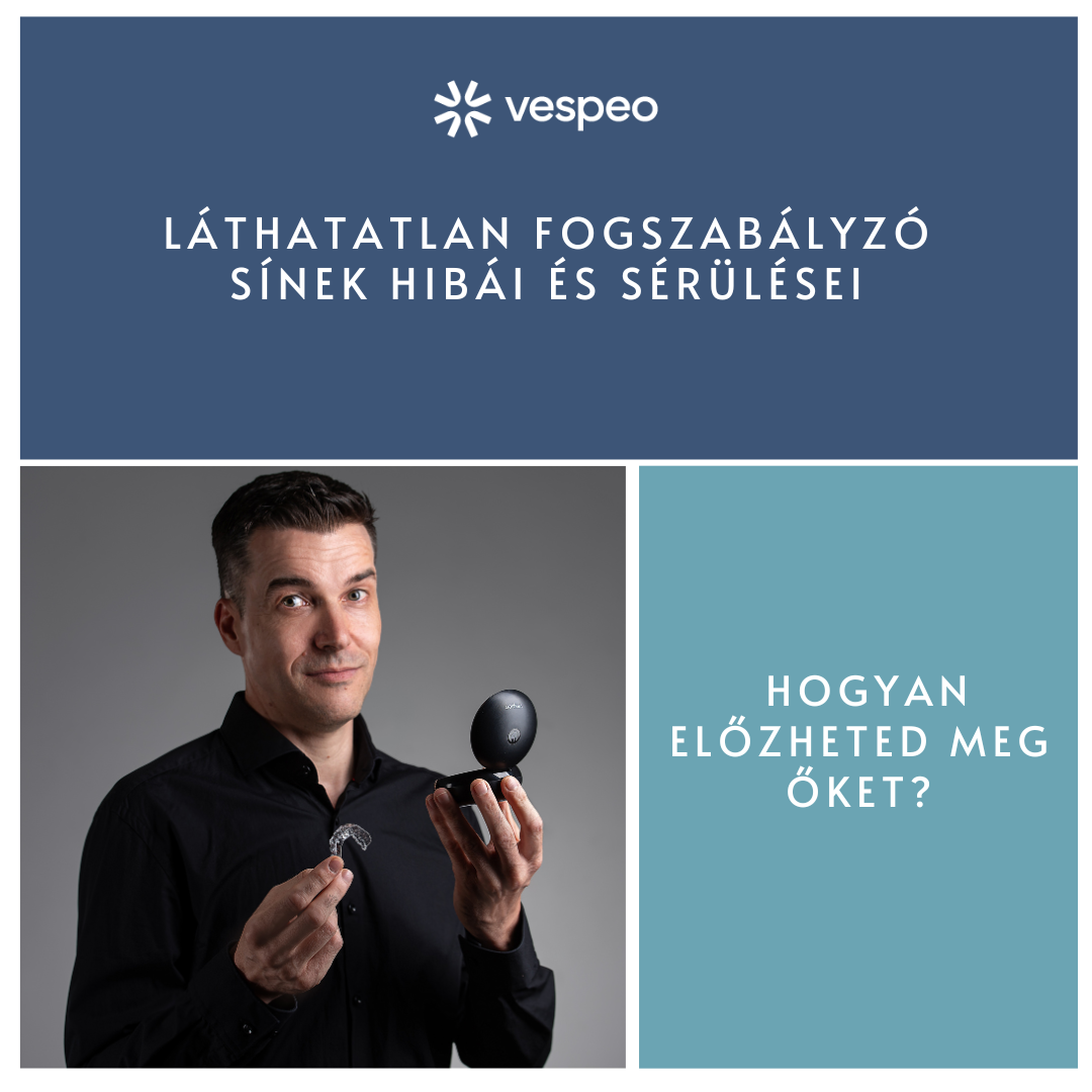 LÁTHATATLAN FOGSZABÁLYZÓ SÍNEK HIBÁI ÉS SÉRÜLÉSEI – hogyan előzheted meg őket